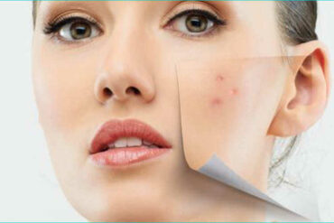 Trattamento Viso effetto Filler